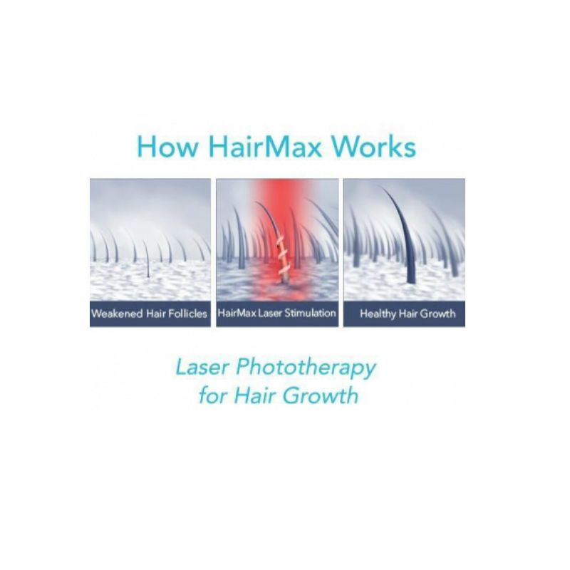 Hairmax LaserBand 82