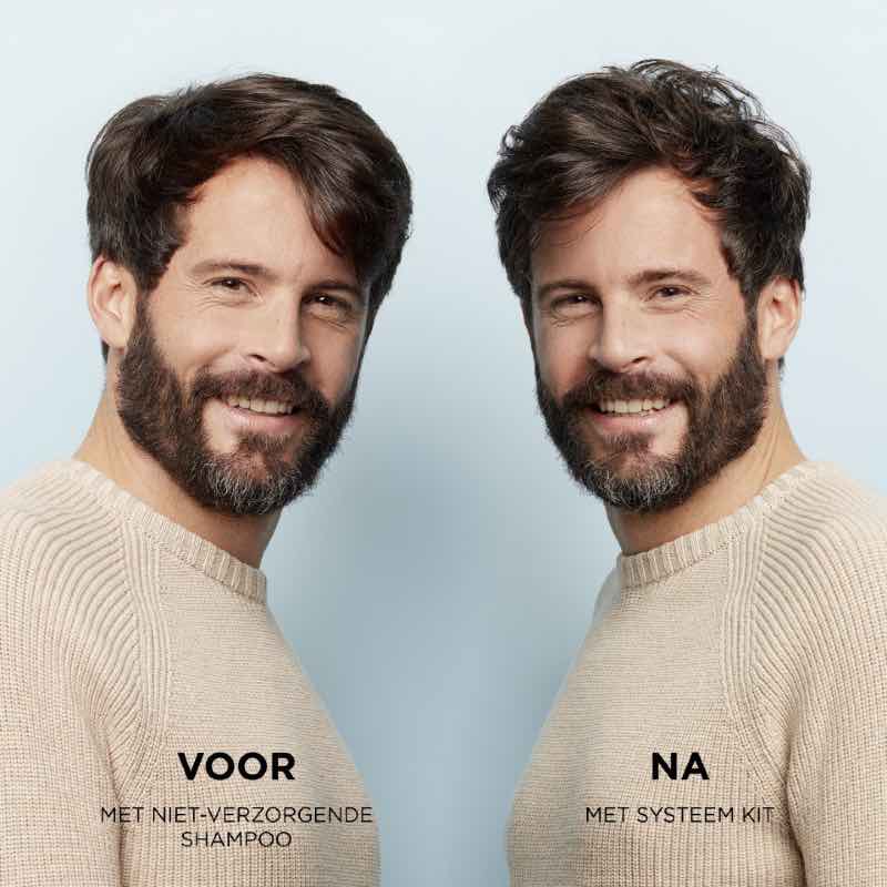 Nioxin Professional System 2 scalp revitalizer voor en na gebruik man kort haar